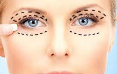 eyelid